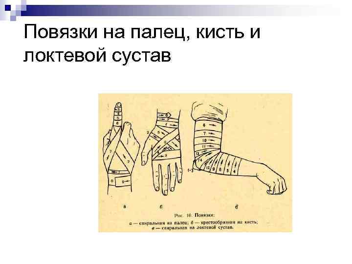 Повязки на палец, кисть и локтевой сустав 
