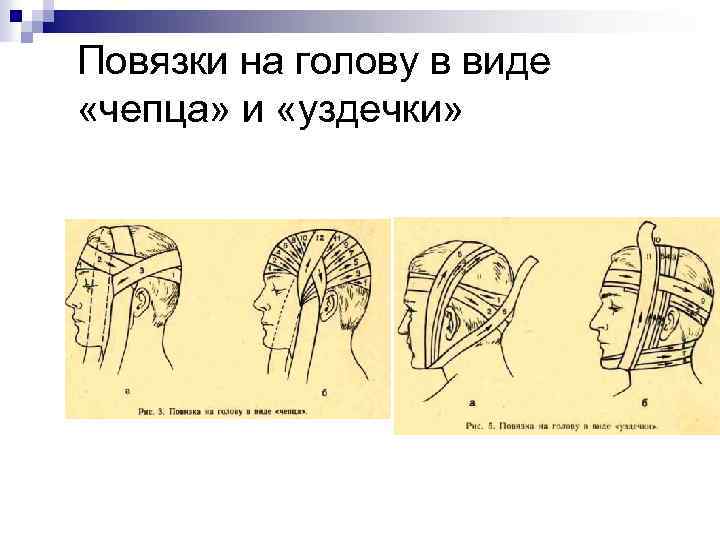 Повязки на голову в виде «чепца» и «уздечки» 