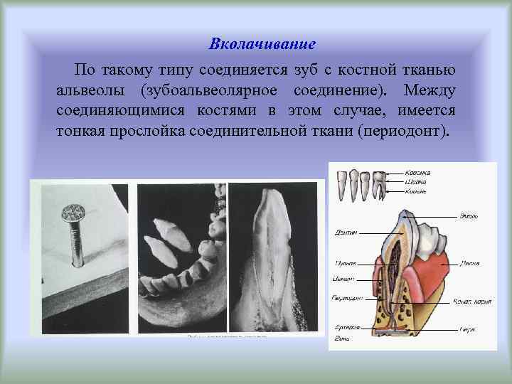 Вколачивание По такому типу соединяется зуб с костной тканью альвеолы (зубоальвеолярное соединение). Между соединяющимися