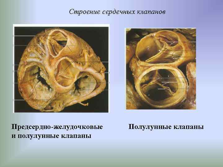 Полулунные и створчатые клапаны