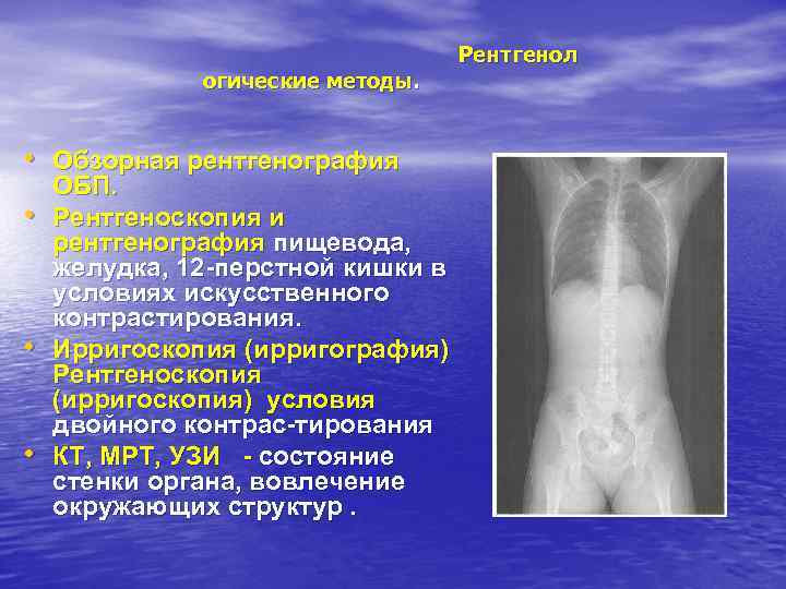 огические методы. • Обзорная рентгенография • • • ОБП. Рентгеноскопия и рентгенография пищевода, желудка,