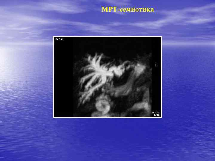 МРТ-семиотика 