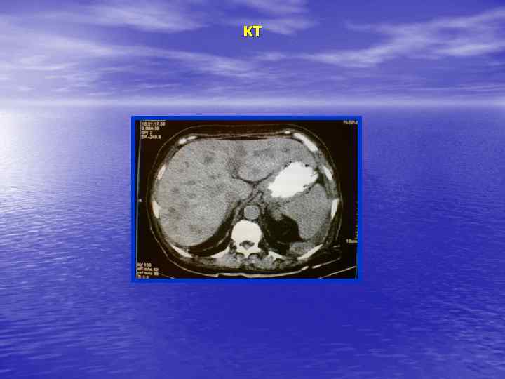 КТ 