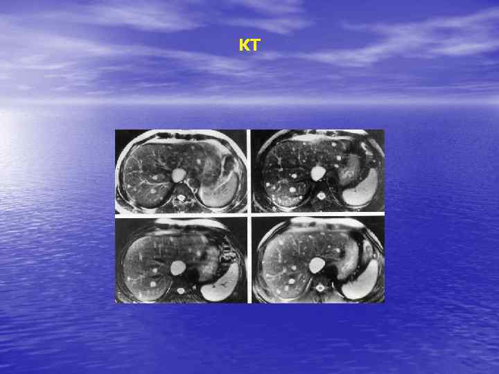 КТ 