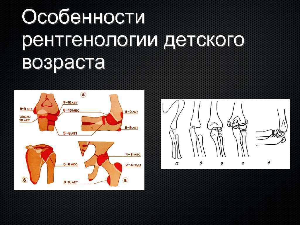 Особенности рентгенологии детского возраста 