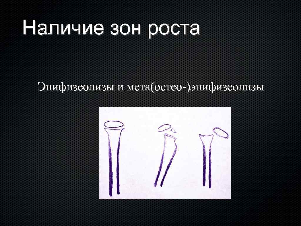 Наличие зона. Зоны роста для презентации. Зона роста кости травматология. Рисунок зоны роста для презентации. Зоны роста ресторана.