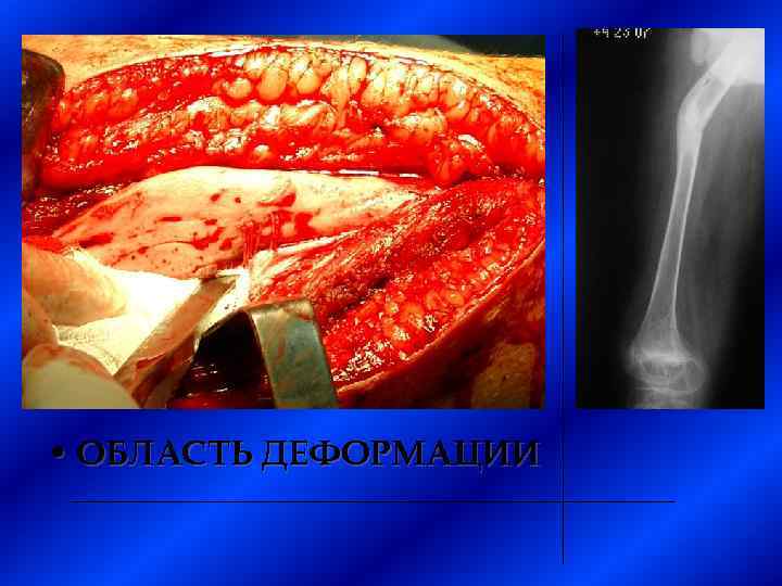  • ОБЛАСТЬ ДЕФОРМАЦИИ 