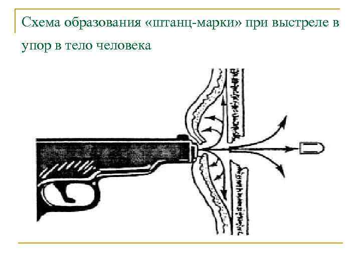 Схема образования «штанц-марки» при выстреле в упор в тело человека 