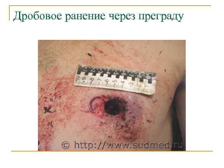 Дробовое ранение через преграду 