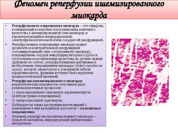Феномен реперфузии ишемизированного миокарда • • Реперфузионное повреждение миокарда – это синдром, возникающий вследствие