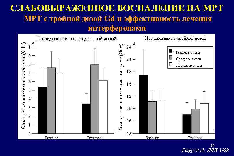 СЛАБОВЫРАЖЕННОЕ ВОСПАЛЕНИЕ НА МРТ с тройной дозой Gd и эффективность лечения интерферонами Исследование с