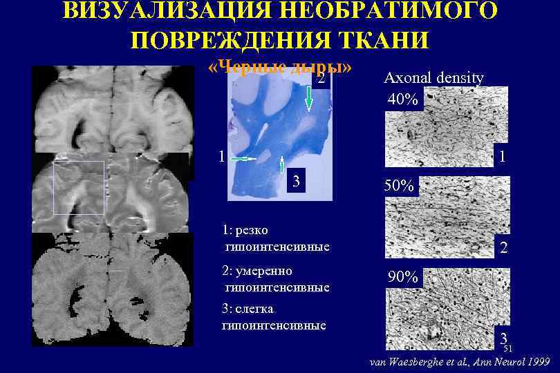 ВИЗУАЛИЗАЦИЯ НЕОБРАТИМОГО ПОВРЕЖДЕНИЯ ТКАНИ «Черные дыры» 2 Axonal density 40% 1 1 3 50%