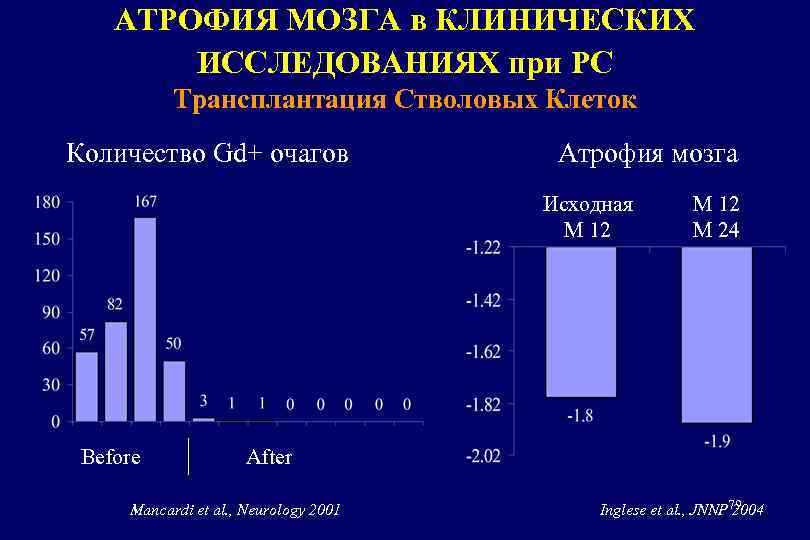 АТРОФИЯ МОЗГА в КЛИНИЧЕСКИХ ИССЛЕДОВАНИЯХ при РС Трансплантация Стволовых Клеток Количество Gd+ очагов Атрофия