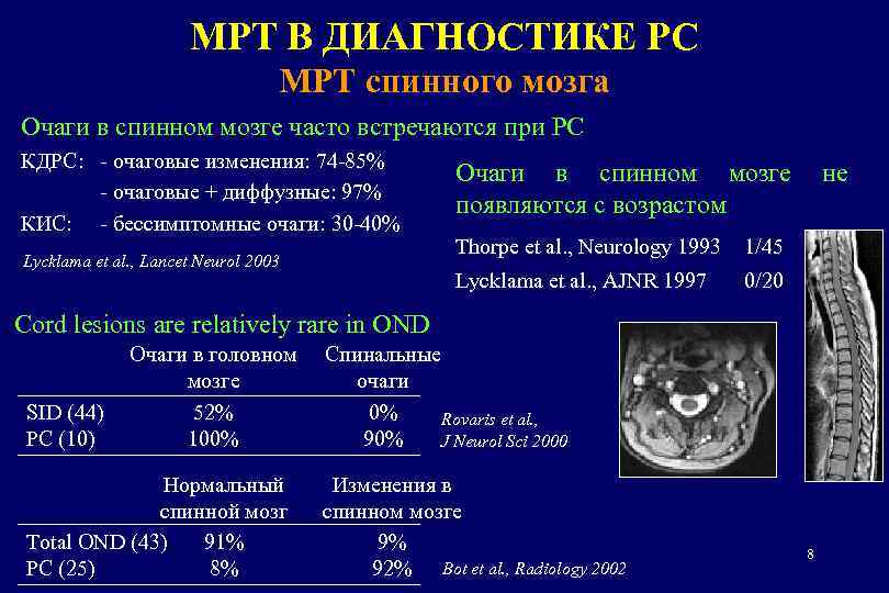МРТ В ДИАГНОСТИКЕ РС МРТ спинного мозга Очаги в спинном мозге часто встречаются при