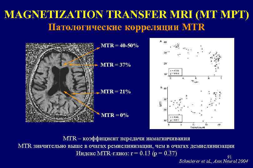 MAGNETIZATION TRANSFER MRI (МТ МРТ) Патологические корреляции MTR = 40 -50% MTR = 37%