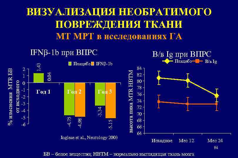 ВИЗУАЛИЗАЦИЯ НЕОБРАТИМОГО ПОВРЕЖДЕНИЯ ТКАНИ MT MРТ в исследованиях ГА В/в Ig при ВПРС -5.