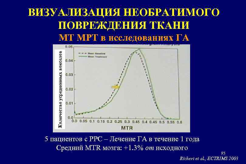 ВИЗУАЛИЗАЦИЯ НЕОБРАТИМОГО ПОВРЕЖДЕНИЯ ТКАНИ Количество усредненных вокселов MT MРТ в исследованиях ГА 5 пациентов