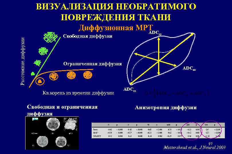 ВИЗУАЛИЗАЦИЯ НЕОБРАТИМОГО ПОВРЕЖДЕНИЯ ТКАНИ Расстояние диффузии Диффузионная МРТ ADC Свободная диффузия Ограниченная диффузия Кв.