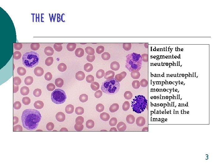 THE WBC Identify the segmented neutrophil, band neutrophil, lymphocyte, monocyte, eosinophil, basophil, and platelet