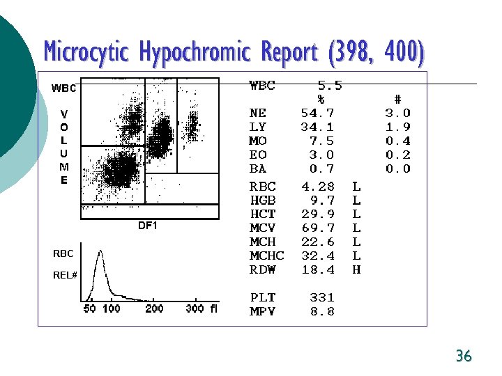 Microcytic Hypochromic Report (398, 400) 36 