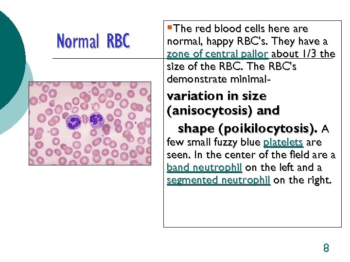 Normal RBC §The red blood cells here are normal, happy RBC's. They have a