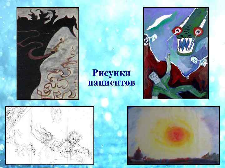 Рисунки пациентов 