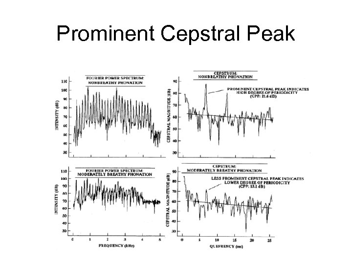 Prominent Cepstral Peak 