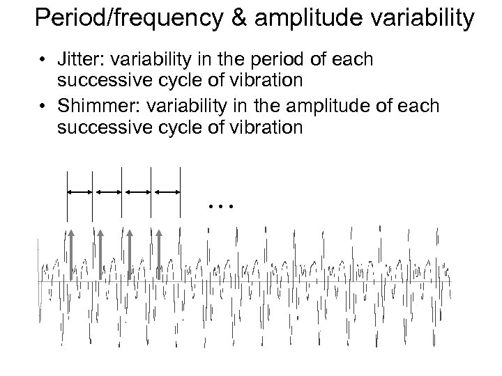 Period/frequency & amplitude variability • Jitter: variability in the period of each successive cycle