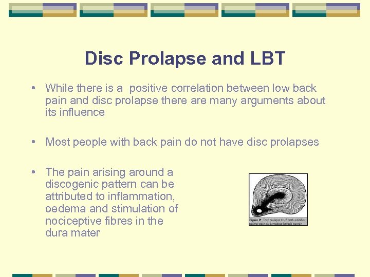 Disc Prolapse and LBT • While there is a positive correlation between low back