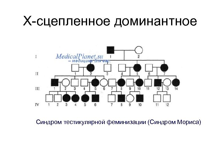 Х-сцепленное доминантное Синдром тестикулярной феминизации (Синдром Мориса) 