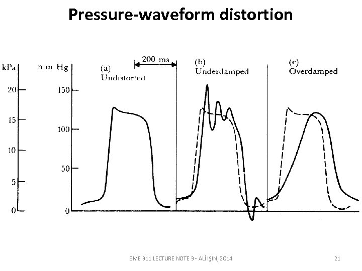 Pressure-waveform distortion BME 311 LECTURE NOTE 3 - ALİ IŞIN, 2014 21 