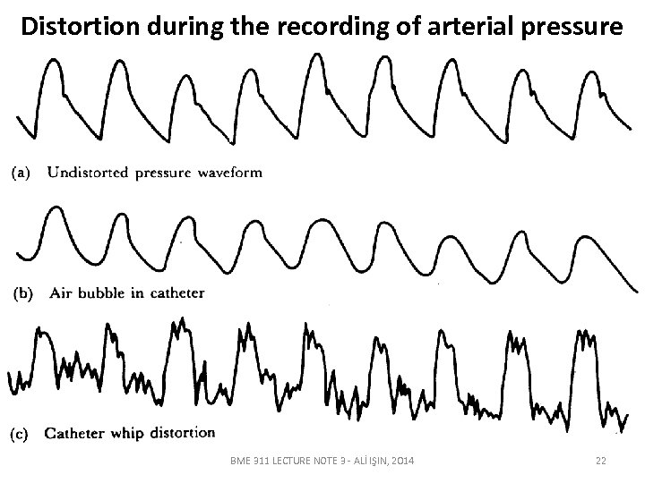 Distortion during the recording of arterial pressure BME 311 LECTURE NOTE 3 - ALİ