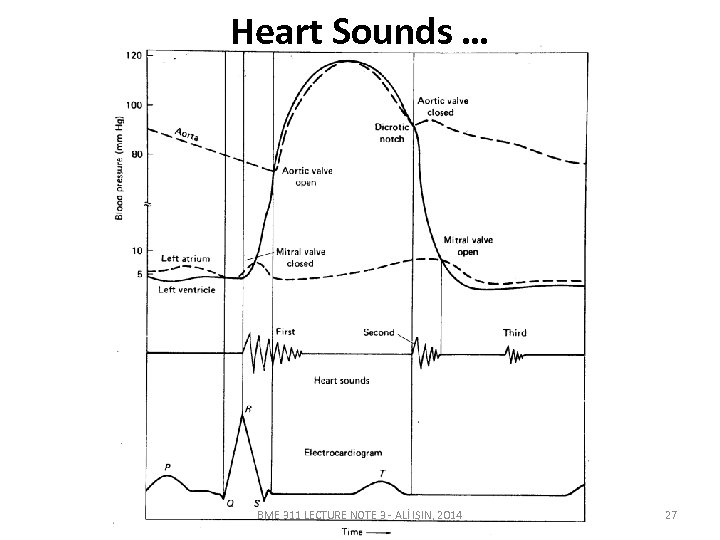 Heart Sounds … BME 311 LECTURE NOTE 3 - ALİ IŞIN, 2014 27 