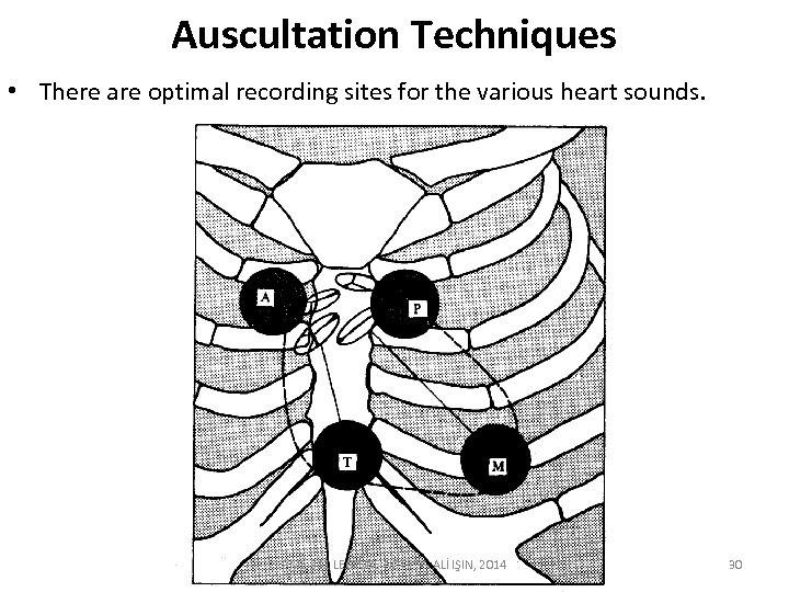 Auscultation Techniques • There are optimal recording sites for the various heart sounds. BME