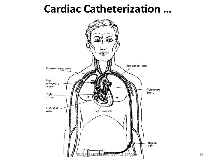 Cardiac Catheterization … BME 311 LECTURE NOTE 3 - ALİ IŞIN, 2014 39 