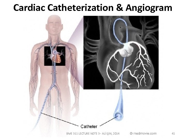 Cardiac Catheterization & Angiogram BME 311 LECTURE NOTE 3 - ALİ IŞIN, 2014 41