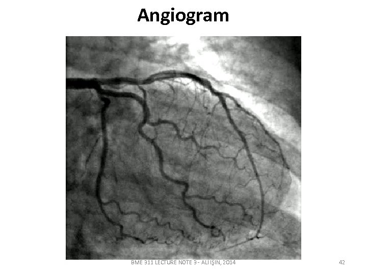 Angiogram BME 311 LECTURE NOTE 3 - ALİ IŞIN, 2014 42 