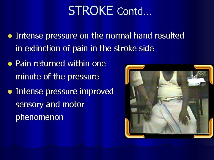 STROKE Contd… l Intense pressure on the normal hand resulted in extinction of pain