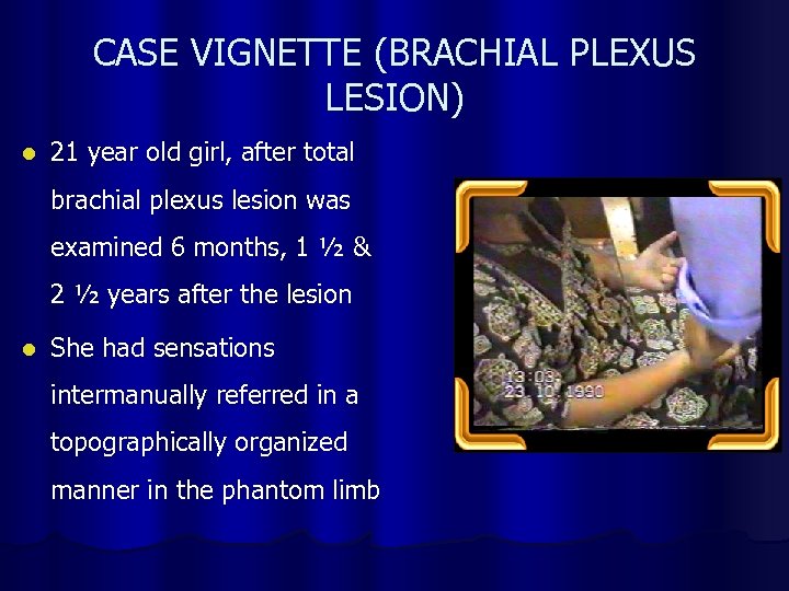 CASE VIGNETTE (BRACHIAL PLEXUS LESION) l 21 year old girl, after total brachial plexus