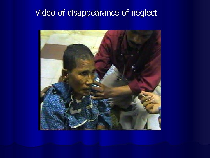 Video of disappearance of neglect 