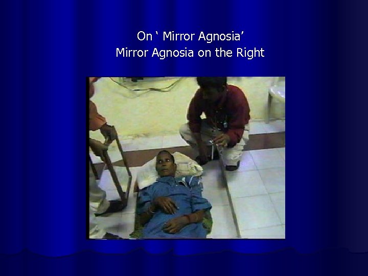 On ‘ Mirror Agnosia’ Mirror Agnosia on the Right 