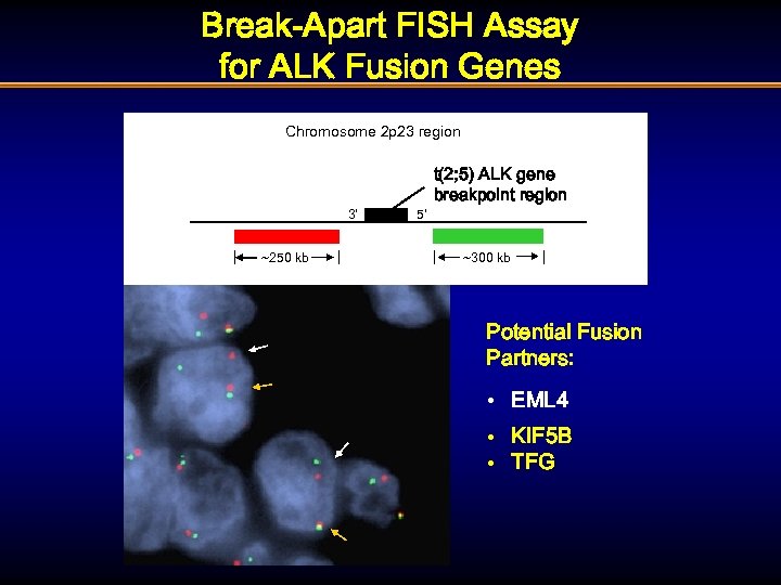 Break-Apart FISH Assay for ALK Fusion Genes Chromosome 2 p 23 region 3’ ~250