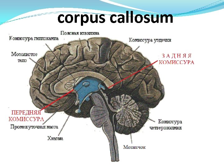 corpus cаllosum 