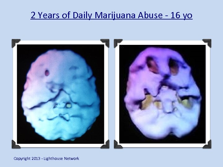 2 Years of Daily Marijuana Abuse - 16 yo Copyright 2013 - Lighthouse Network