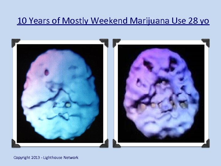 10 Years of Mostly Weekend Marijuana Use 28 yo Copyright 2013 - Lighthouse Network