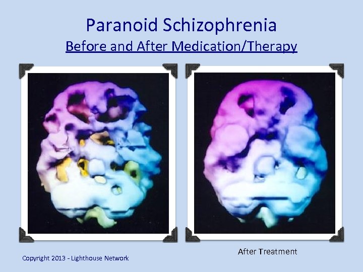 Paranoid Schizophrenia Before and After Medication/Therapy Copyright 2013 - Lighthouse Network After Treatment 
