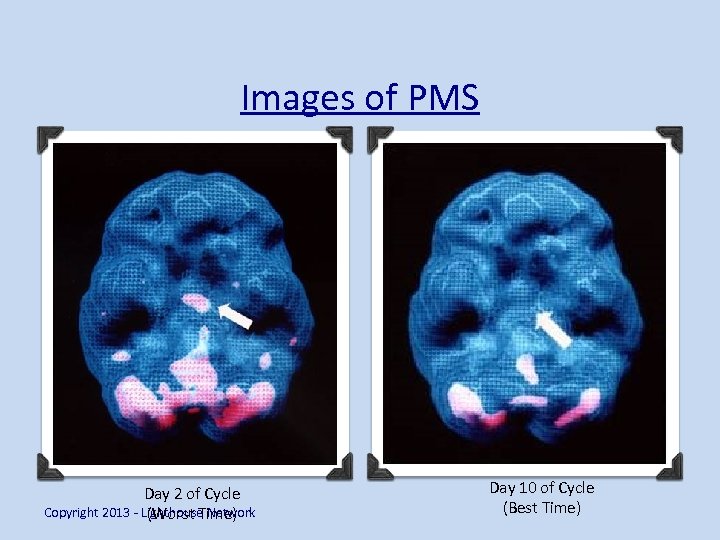 Images of PMS Day 2 of Cycle Copyright 2013 - Lighthouse Network (Worst Time)