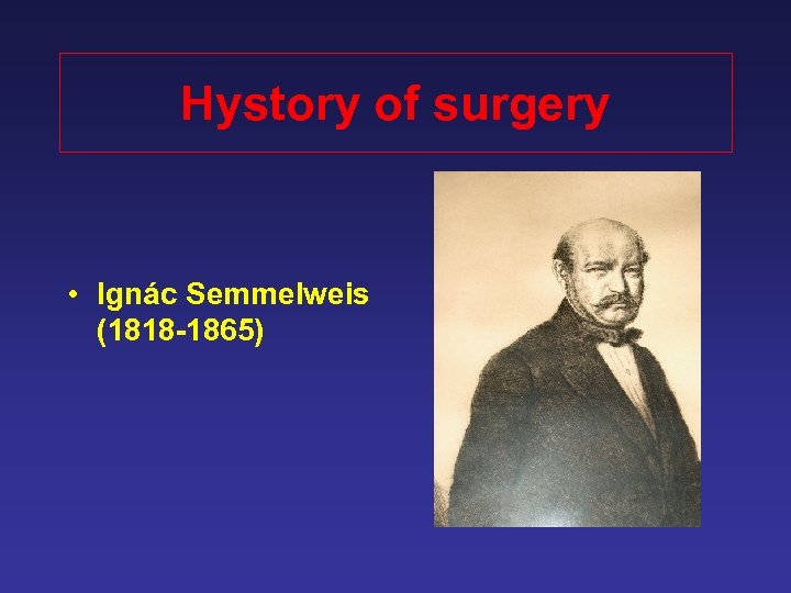 Hystory of surgery • Ignác Semmelweis (1818 -1865) 