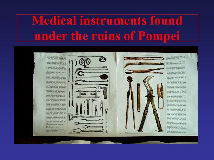 Medical instruments found under the ruins of Pompei 