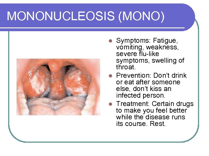 MONONUCLEOSIS (MONO) Symptoms: Fatigue, vomiting, weakness, severe flu-like symptoms, swelling of throat. l Prevention: